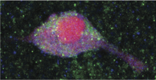 Imagen de una célula de cerebro de ratón, con receptores de insulina (puntos verdes) que cuando se activa se produce liberación de dopamina (el color rosa es el núcleo de la neurona.)