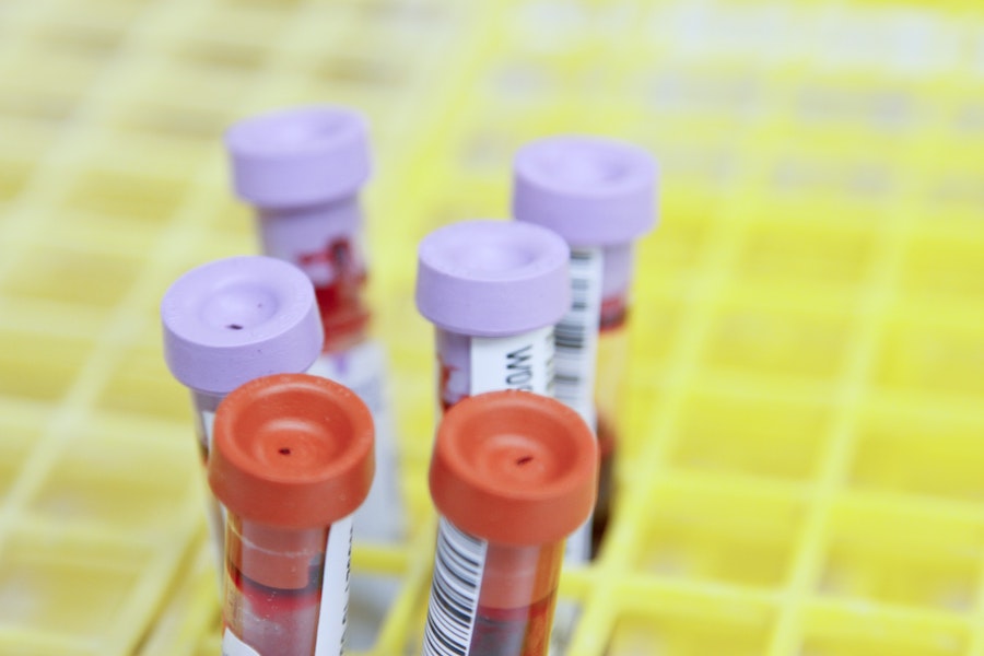 biomarcador biomarcadores Canarias hepatitis c analisis de sangre